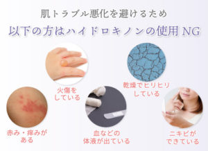 肌トラブル悪化を避けるため 以下の方はハイドロキノンの使用NG 。①赤み・痒みがある②火傷をしている③血などの体液が出ている④乾燥でヒリヒリしている⑤ニキビができている