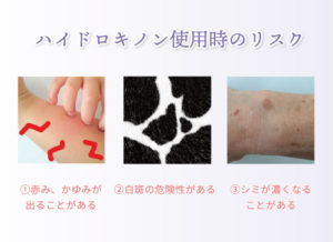 ハイドロキノン使用時のリスク ①赤み、かゆみが出ることがある ②白斑の危険性がある ③シミが濃くなることがある